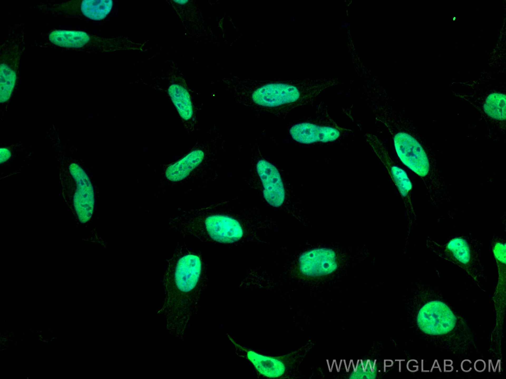 Immunofluorescence (IF) / fluorescent staining of HeLa cells using HDAC1 Polyclonal antibody (10197-1-AP)