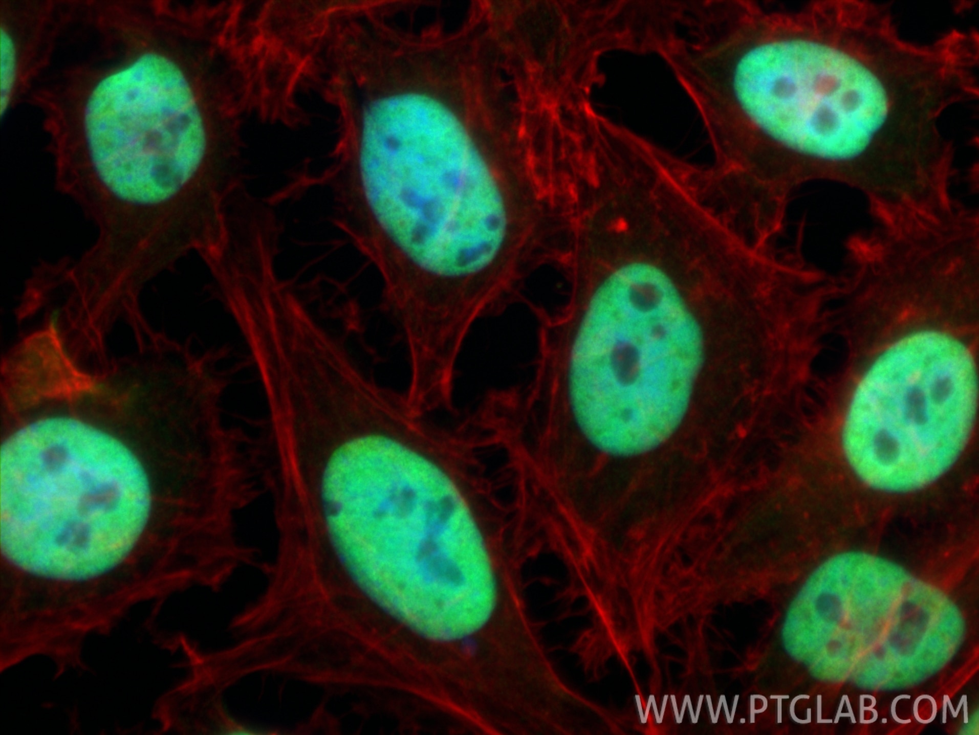 Immunofluorescent analysis of (4% PFA) fixed HeLa cells using HDAC1 antibody (10197-1-AP) at dilution of 1:400 and CoraLite®488-Conjugated Goat Anti-Rabbit IgG(H+L) (SA00013-2), CL594-phalloidin (red). Immunofluorescence (IF) / fluorescent staining of HeLa cells using HDAC1 Polyclonal antibody (10197-1-AP)