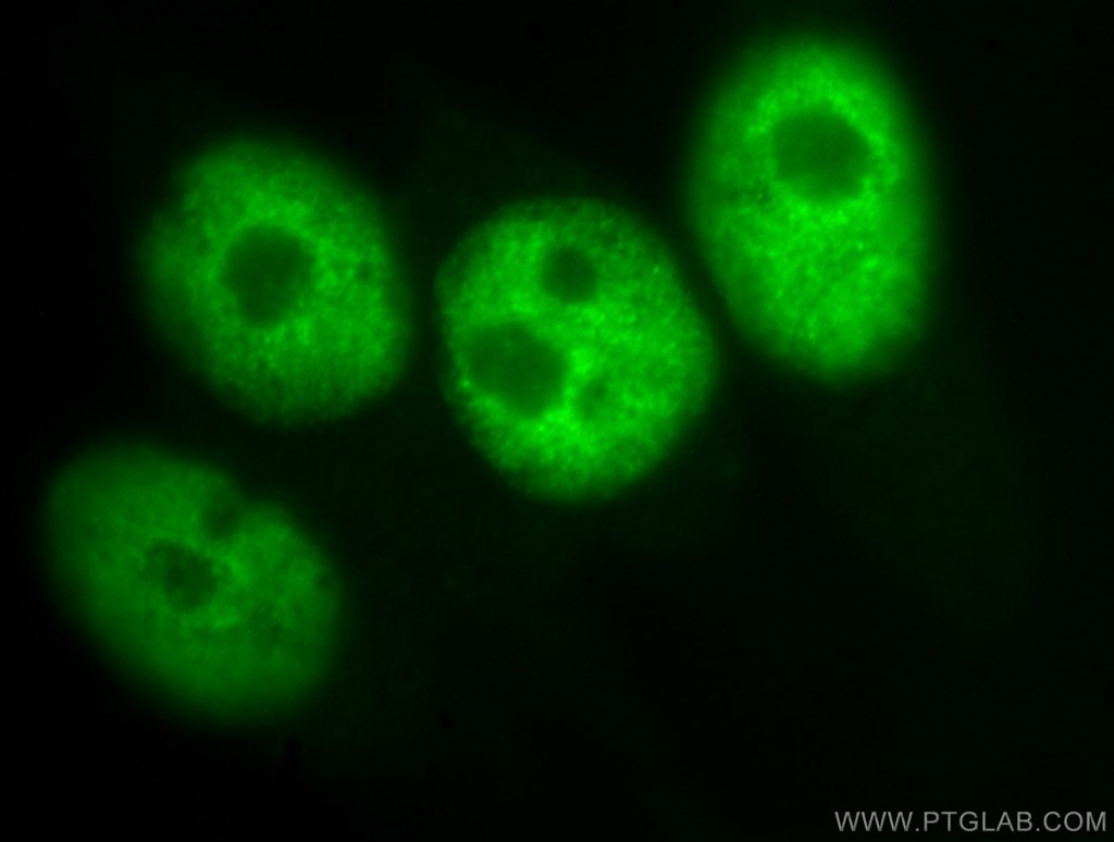 IF Staining of SH-SY5Y using 10197-1-AP