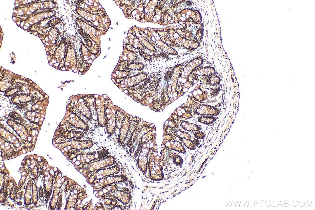 Immunohistochemical analysis of paraffin-embedded mouse colon tissue slide using 10197-1-AP (HDAC1 antibody) at dilution of 1:1000 (under 10x lens). Heat mediated antigen retrieval with Tris-EDTA buffer (pH 9.0). Immunohistochemistry (IHC) staining of mouse colon tissue using HDAC1 Polyclonal antibody (10197-1-AP)