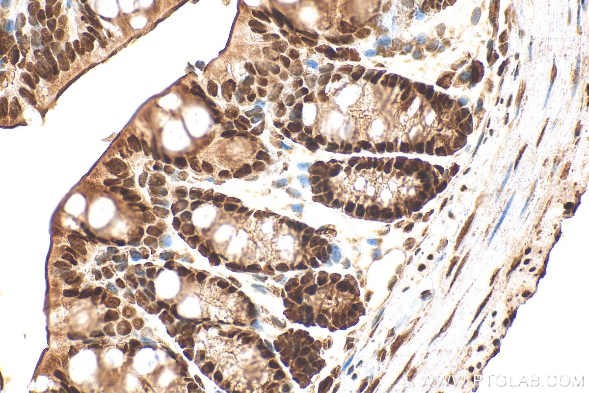 Immunohistochemical analysis of paraffin-embedded mouse colon tissue slide using 10197-1-AP (HDAC1 antibody) at dilution of 1:1000 (under 40x lens). Heat mediated antigen retrieval with Tris-EDTA buffer (pH 9.0). Immunohistochemistry (IHC) staining of mouse colon tissue using HDAC1 Polyclonal antibody (10197-1-AP)