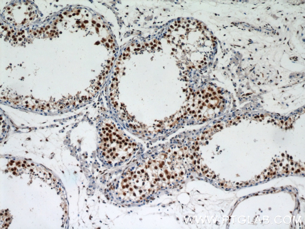 Immunohistochemistry (IHC) staining of human testis tissue using HDAC1 Polyclonal antibody (10197-1-AP)