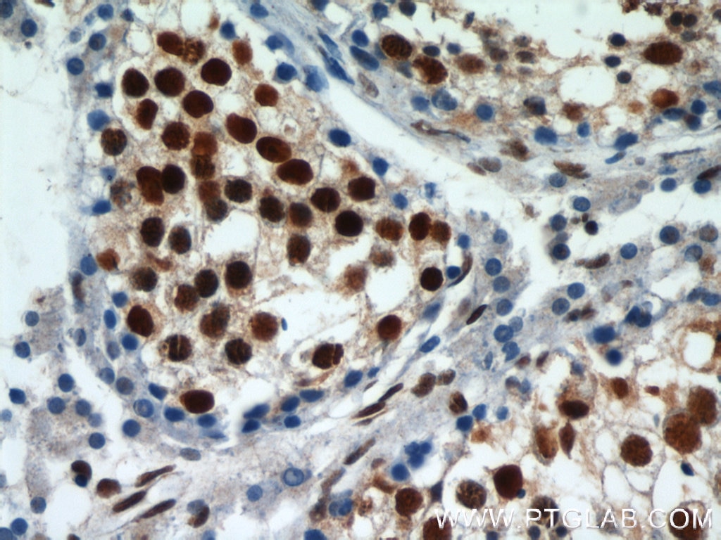IHC staining of paraffin-embedded human testis using HDAC1 antibody (10197-1-AP) at a dilution of 1:50 (under 40x lens)