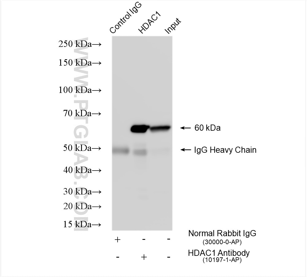 IP experiment of HeLa using 10197-1-AP