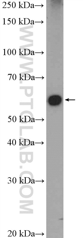 Western Blot (WB) analysis of mouse testis tissue using HDAC1 Polyclonal antibody (10197-1-AP)