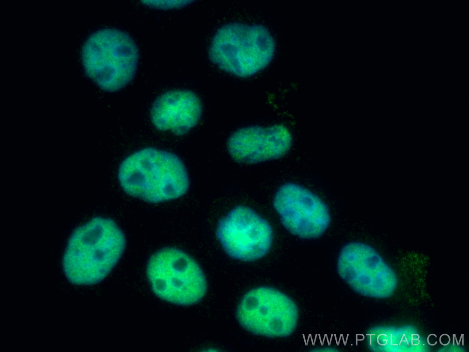 Immunofluorescence (IF) / fluorescent staining of A431 cells using HDAC1 Monoclonal antibody (66085-1-Ig)