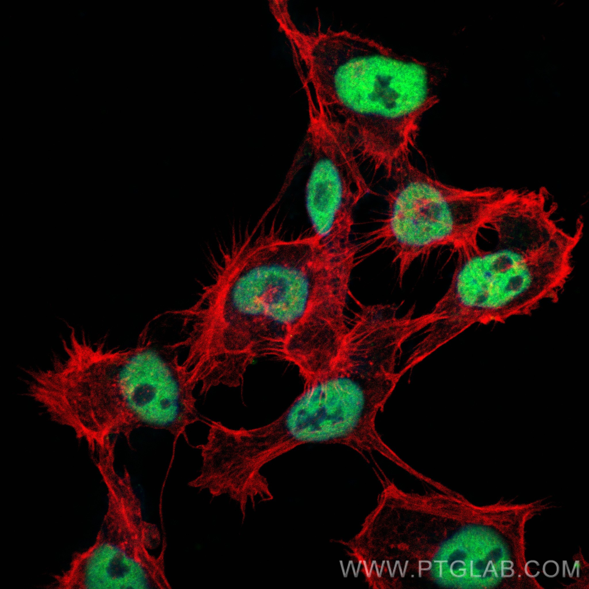 Immunofluorescence (IF) / fluorescent staining of A431 cells using HDAC1 Monoclonal antibody (66085-1-Ig)