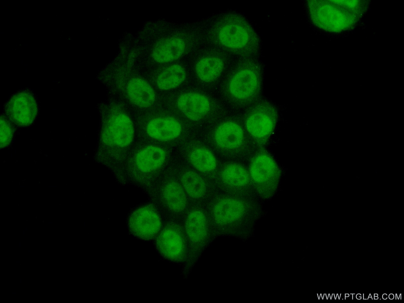 Immunofluorescence (IF) / fluorescent staining of HeLa cells using HDAC1 Monoclonal antibody (66085-1-Ig)