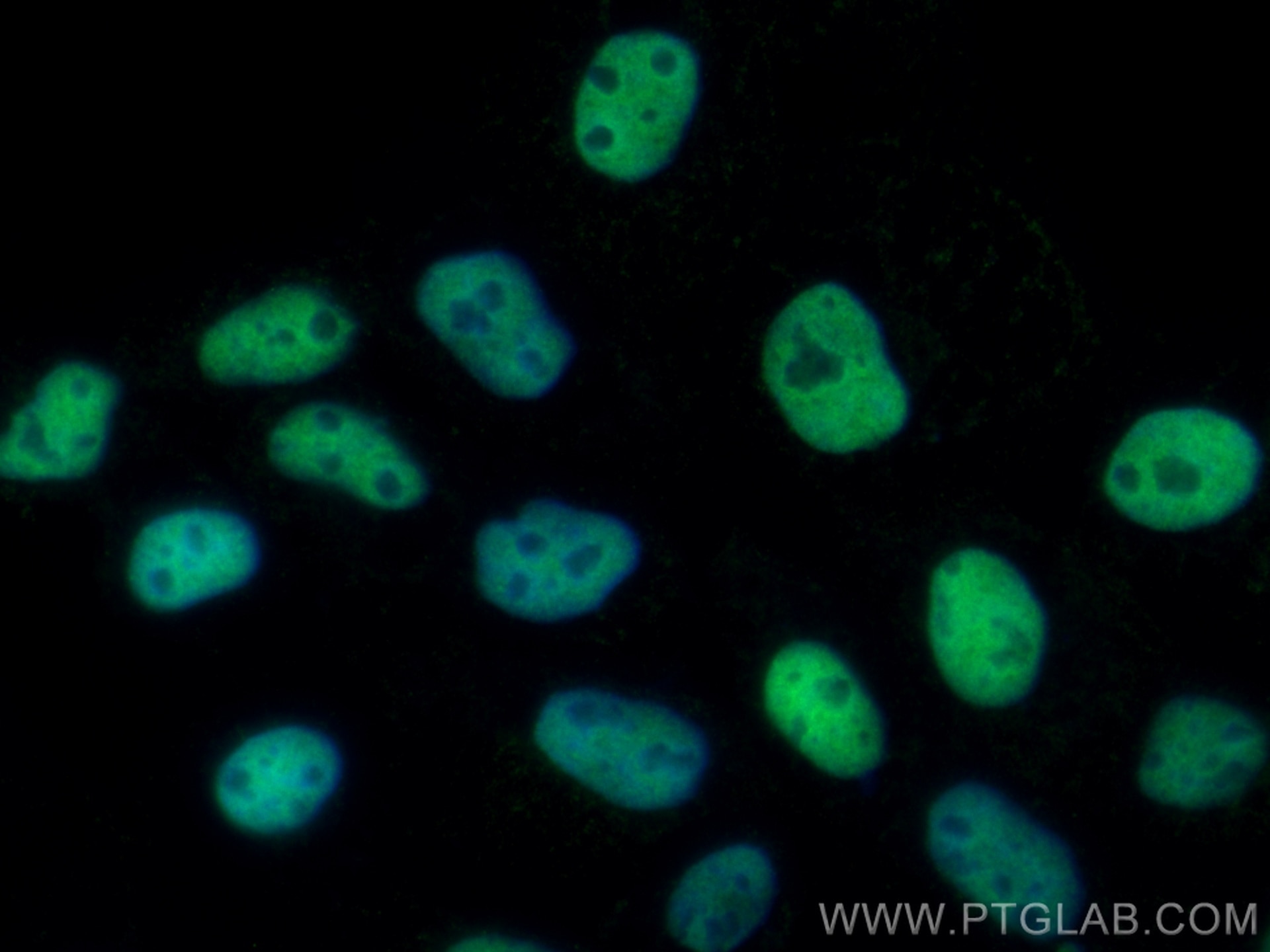 Immunofluorescence (IF) / fluorescent staining of A431 cells using CoraLite® Plus 488-conjugated HDAC1 Monoclonal ant (CL488-66085)