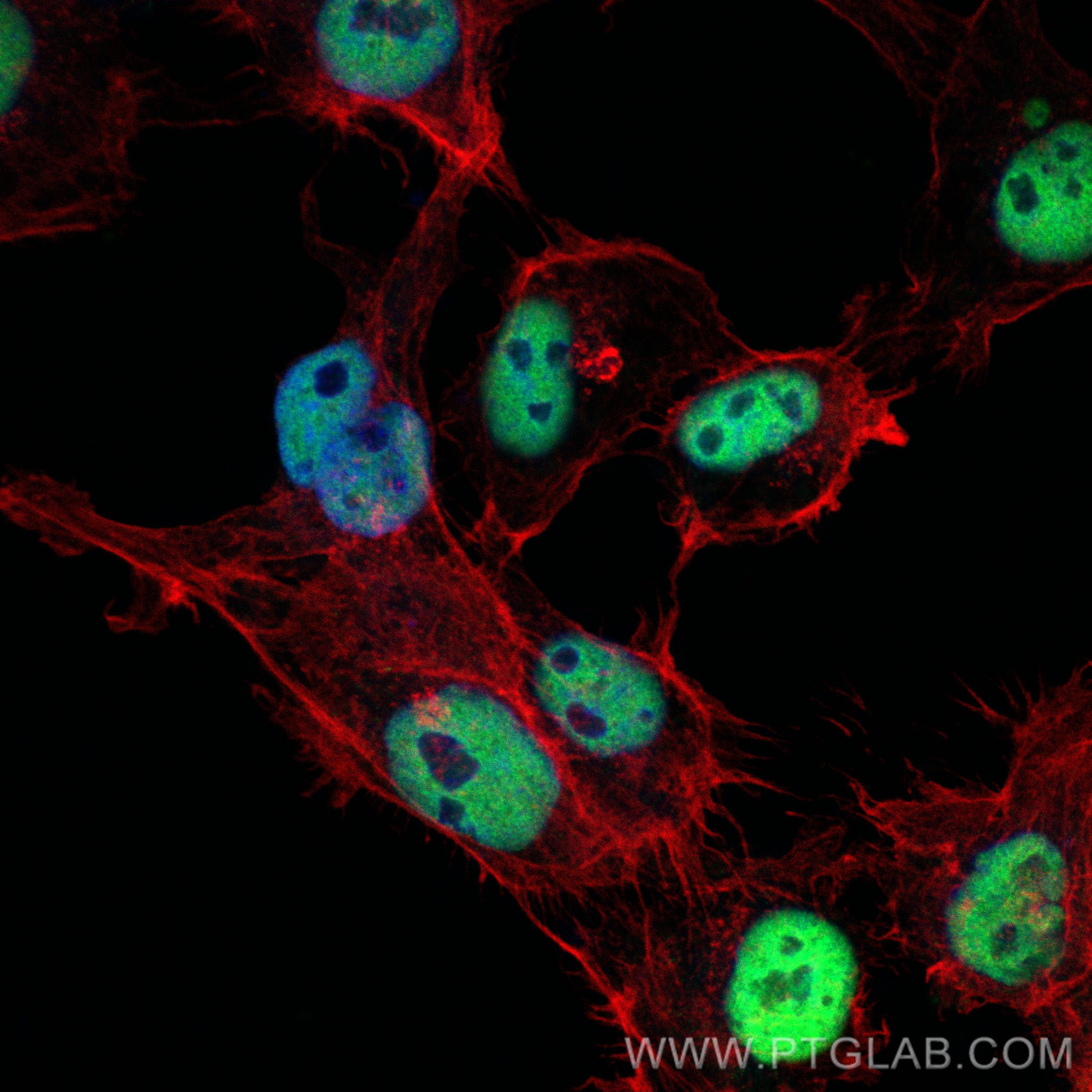 Immunofluorescence (IF) / fluorescent staining of A431 cells using CoraLite® Plus 488-conjugated HDAC1 Monoclonal ant (CL488-66085)