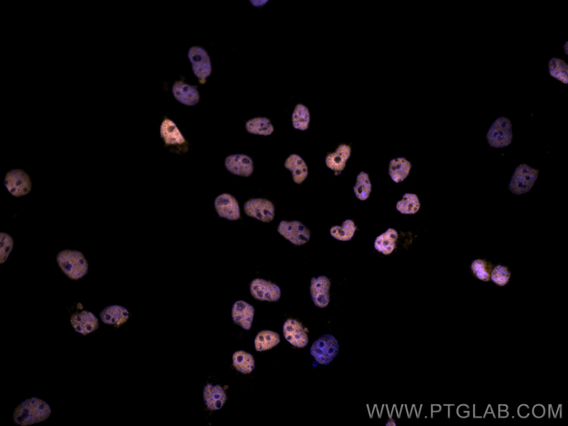 IF Staining of A431 using CL555-66085