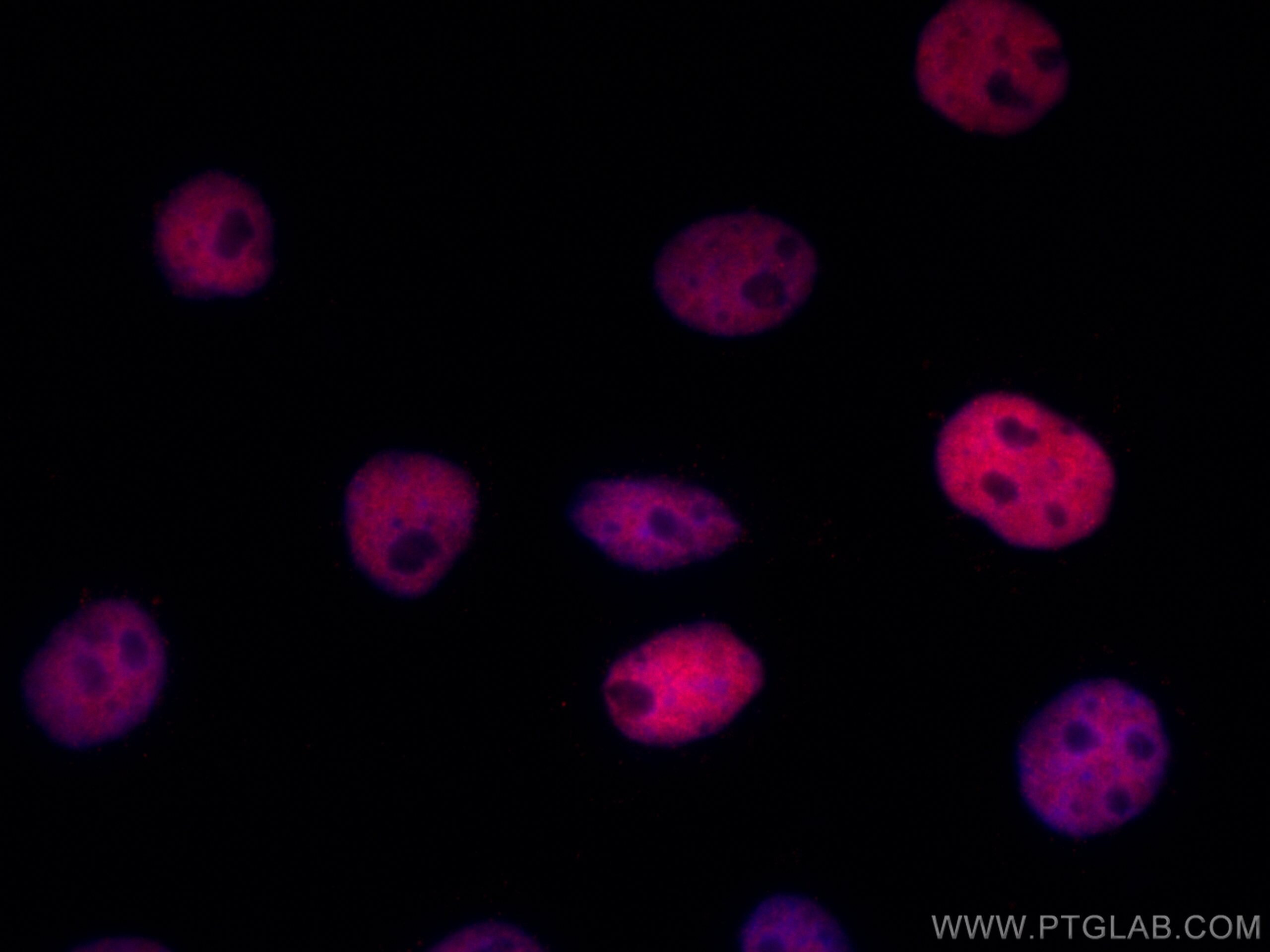 Immunofluorescence (IF) / fluorescent staining of A431 cells using CoraLite®594-conjugated HDAC1 Monoclonal antibody (CL594-66085)