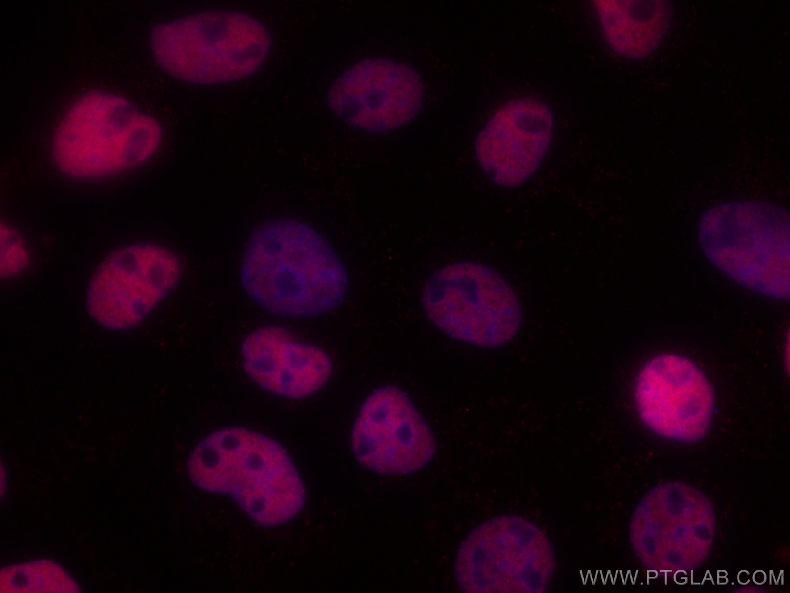 IF Staining of A431 using CL594-66085