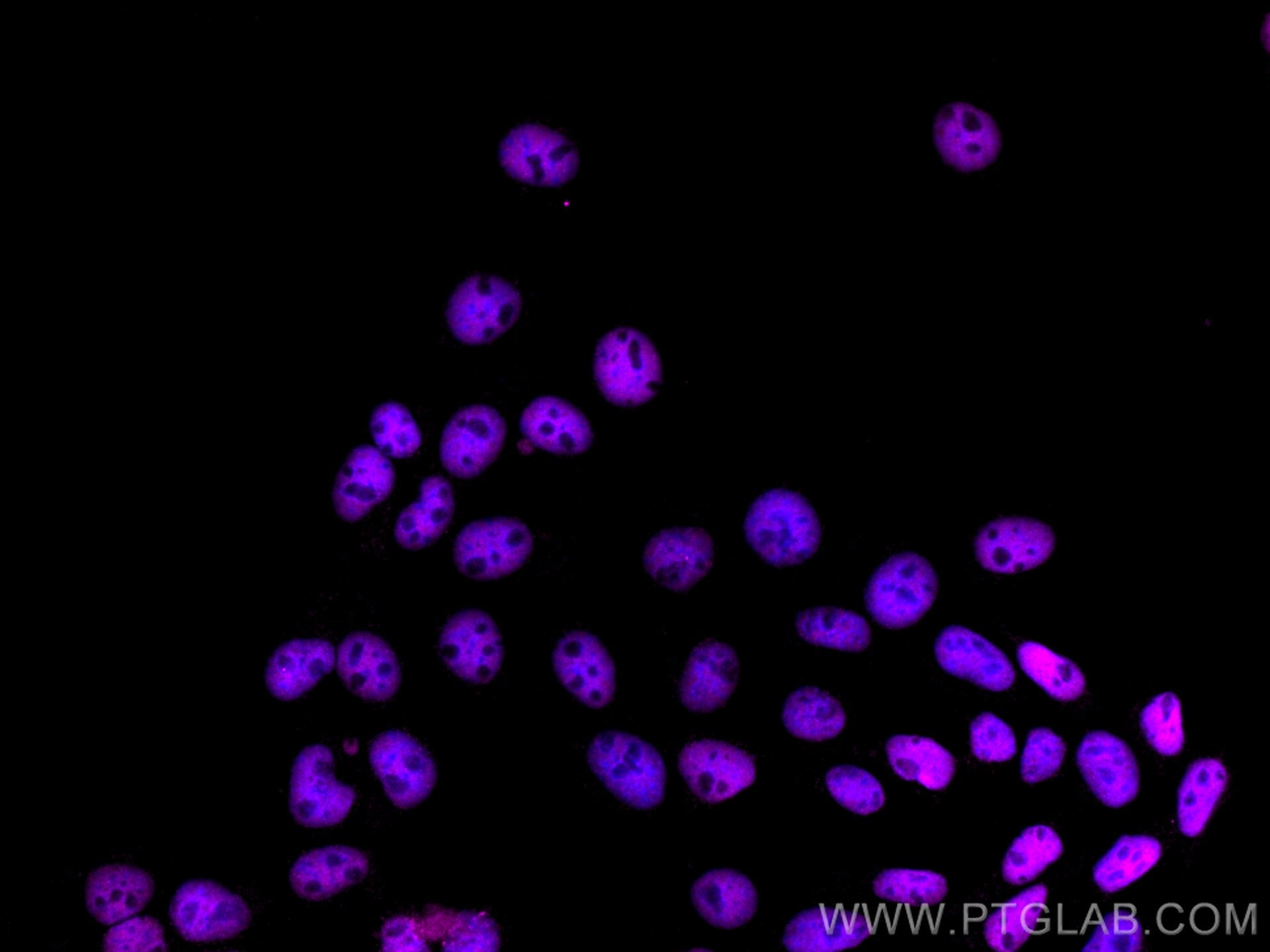 Immunofluorescence (IF) / fluorescent staining of A431 cells using CoraLite® Plus 647-conjugated HDAC1 Monoclonal ant (CL647-66085)