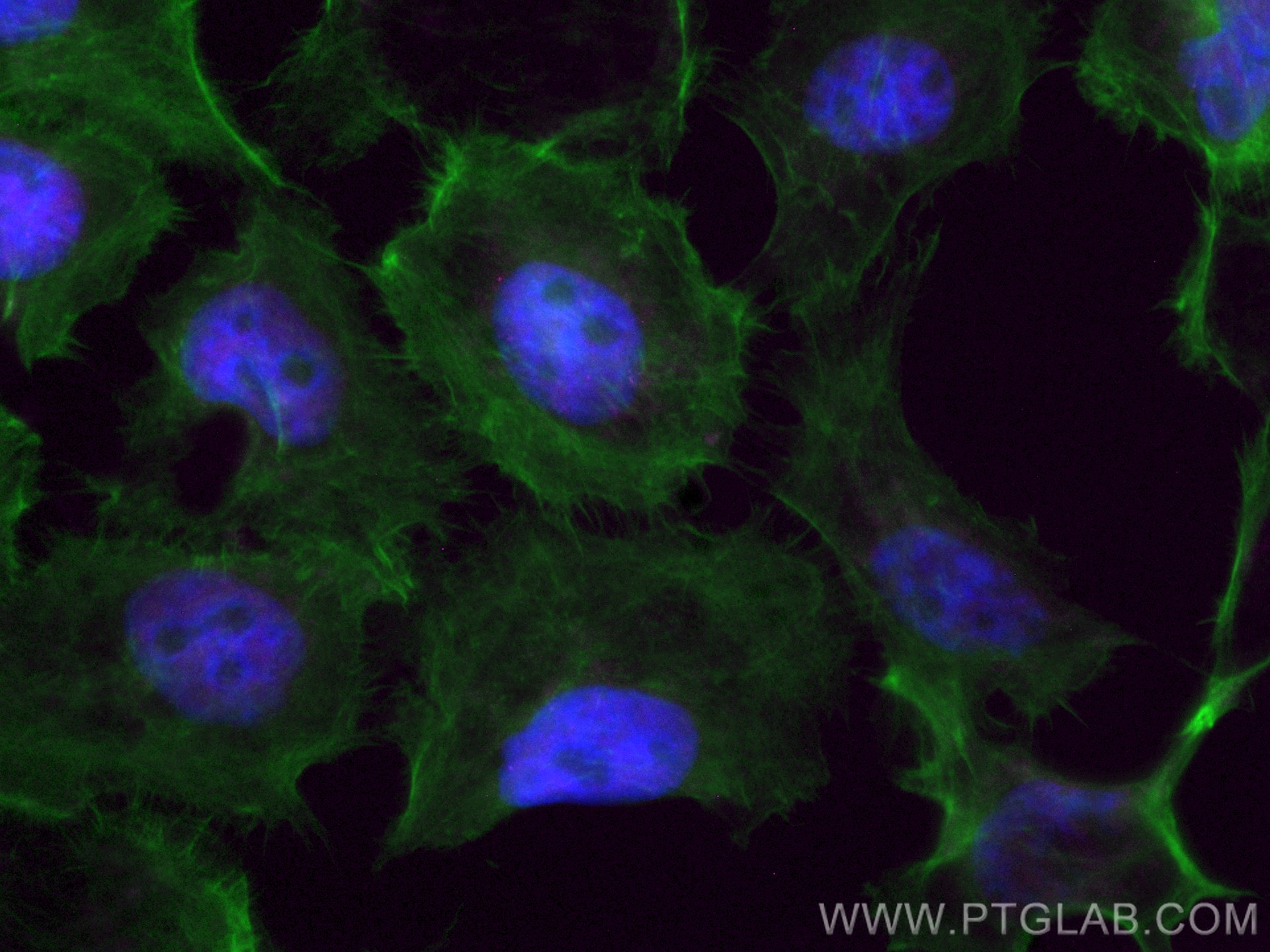 IF Staining of A431 using CL647-66085