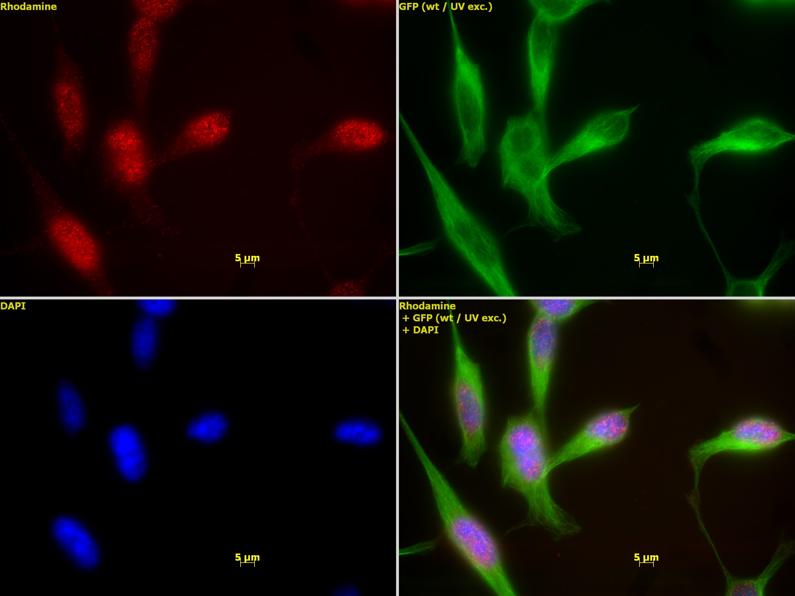 HDAC1 antibody (mAb) (Clone 10E2) | Proteintech