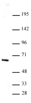 HDAC1 antibody (mAb) tested by Western blot. Nuclear extract of HeLa cells (20 ug per lane) probed with HDAC1 antibody at a dilution of 1 ug/ml.