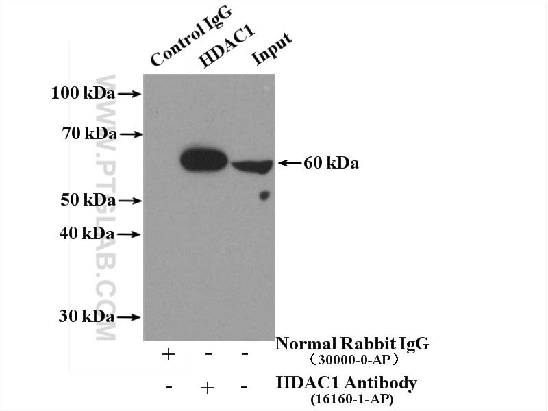 Immunoprecipitation (IP) experiment of mouse testis tissue using HDAC1-specific Polyclonal antibody (16160-1-AP)