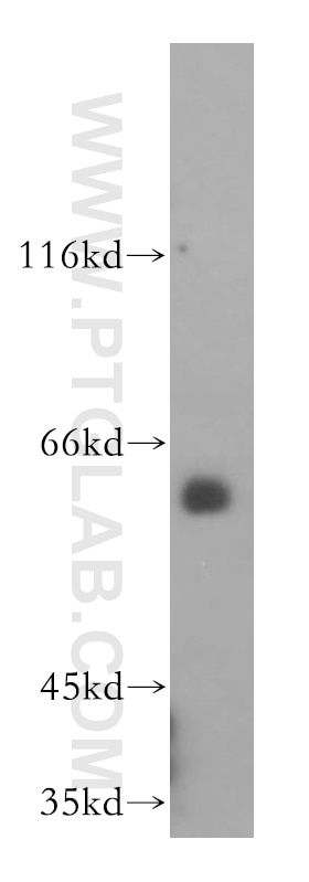 Western Blot (WB) analysis of mouse brain tissue using HDAC1-specific Polyclonal antibody (16160-1-AP)