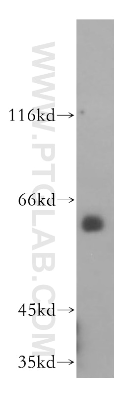 WB analysis of mouse brain using 16160-1-AP