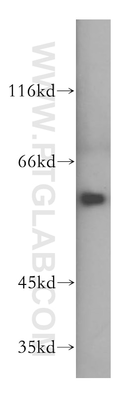 Western Blot (WB) analysis of mouse testis tissue using HDAC1-specific Polyclonal antibody (16160-1-AP)