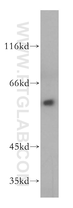 Western Blot (WB) analysis of mouse testis tissue using HDAC1-specific Polyclonal antibody (16160-1-AP)