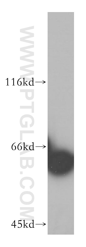 WB analysis of mouse thymus using 16160-1-AP