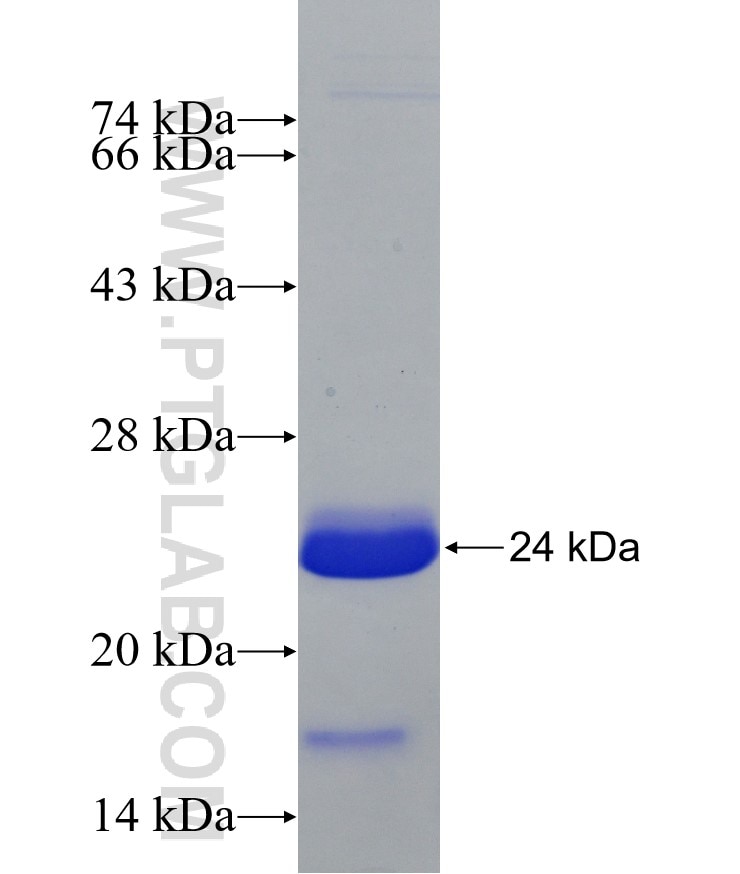 HDAC1-specific fusion protein Ag10722 SDS-PAGE