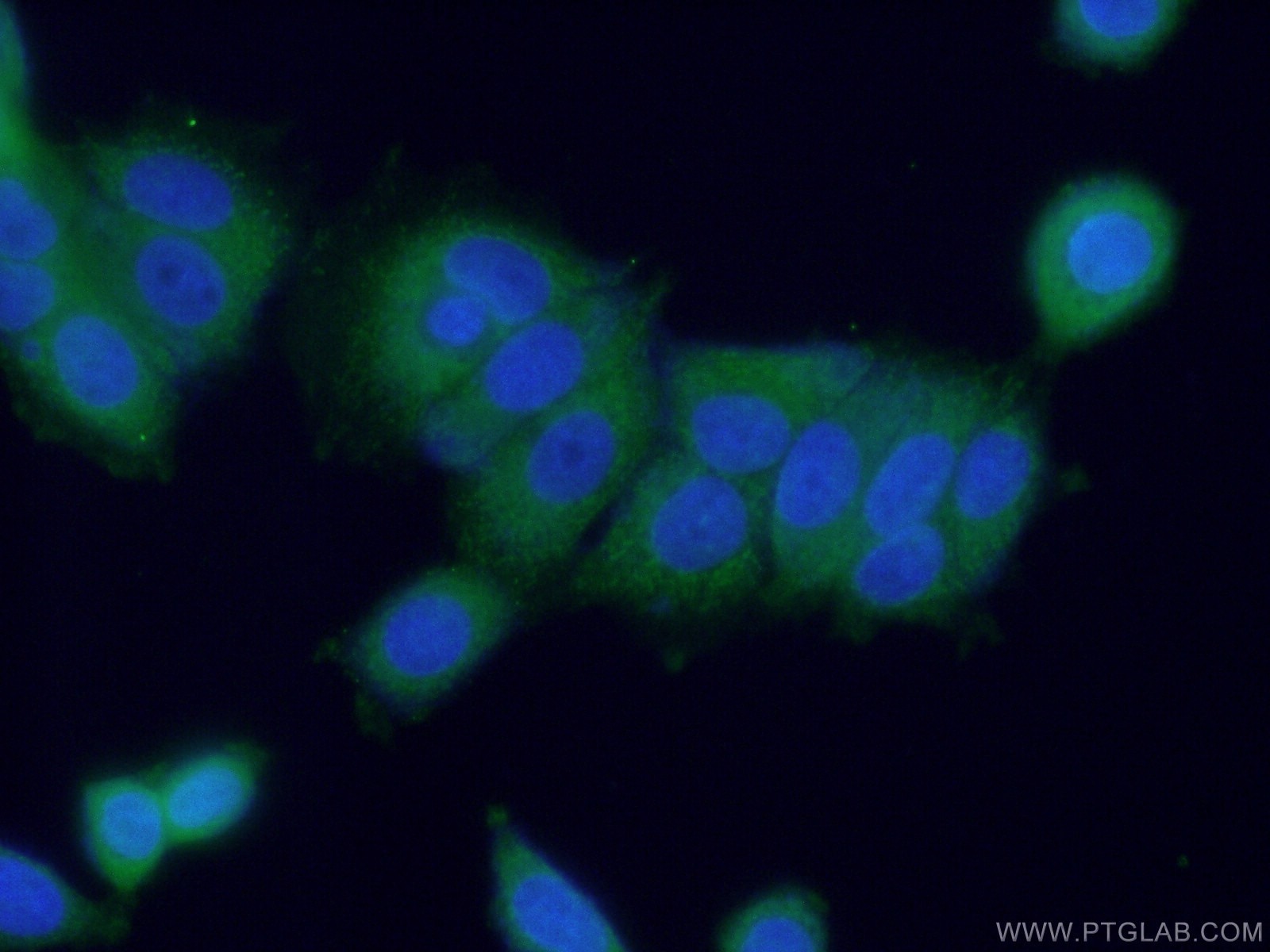 Immunofluorescence (IF) / fluorescent staining of MCF-7 cells using HDAC10 Polyclonal antibody (24913-1-AP)