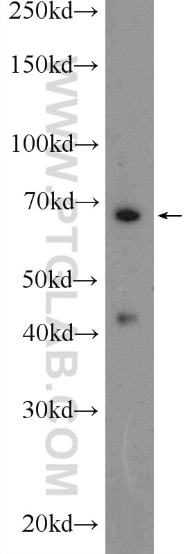 Western Blot (WB) analysis of mouse thymus tissue using HDAC10 Polyclonal antibody (24913-1-AP)