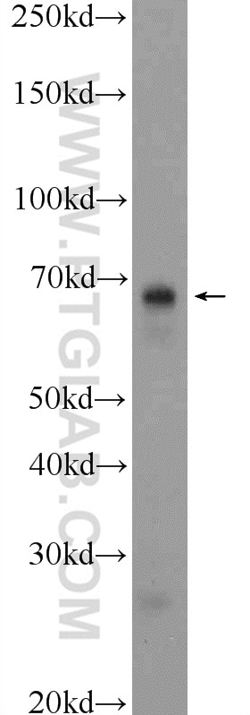 Western Blot (WB) analysis of fetal human brain tissue using HDAC10 Polyclonal antibody (24913-1-AP)