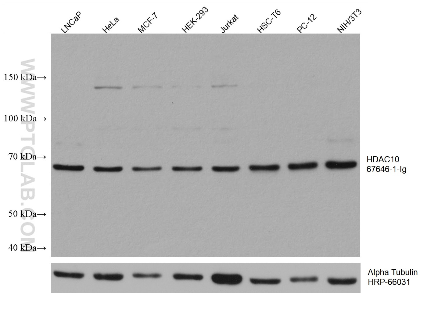 HDAC10