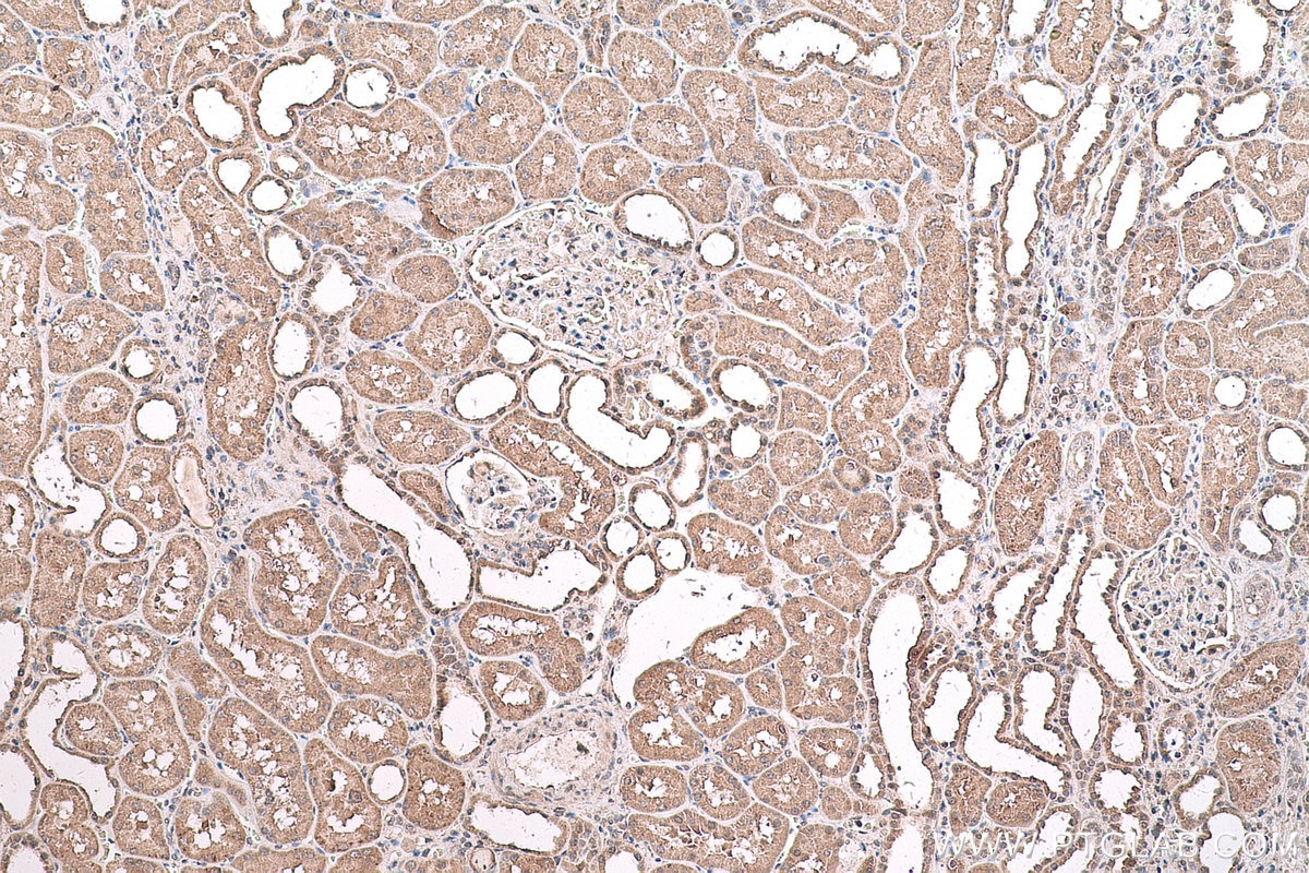 Immunohistochemistry (IHC) staining of human kidney tissue using HDAC11 Monoclonal antibody (67949-1-Ig)