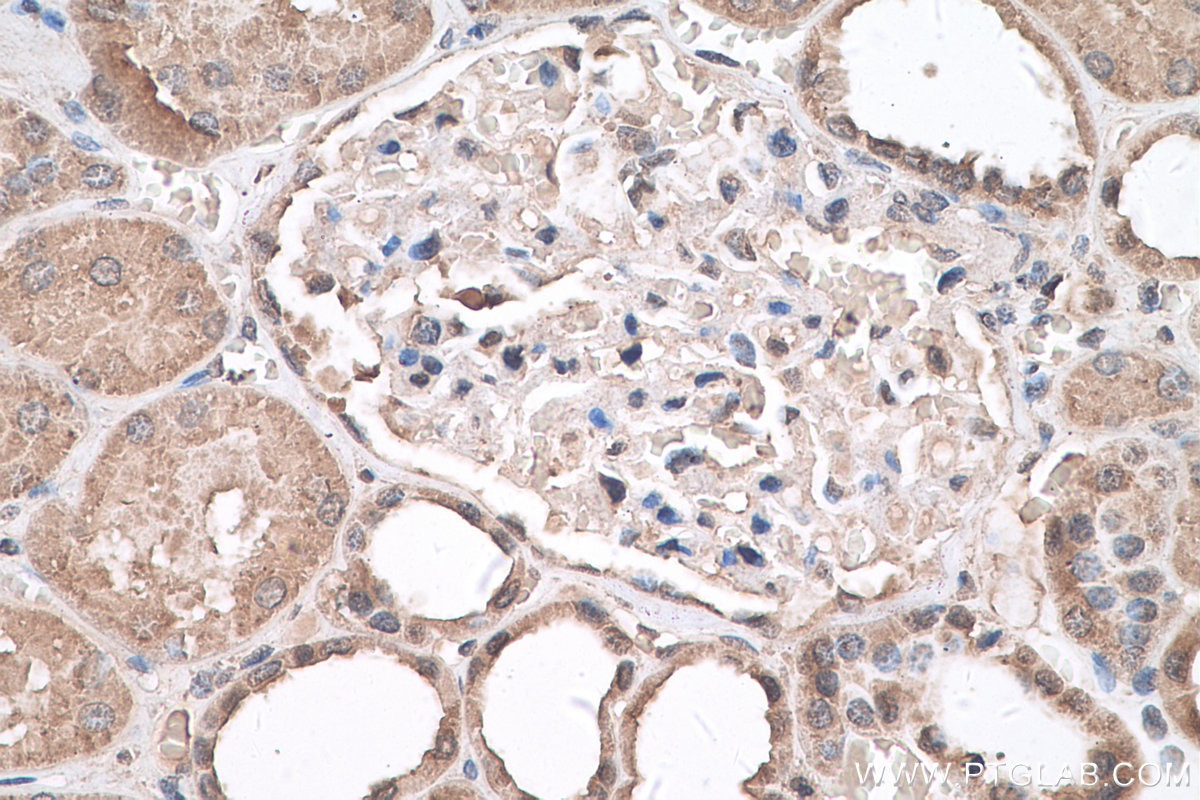 Immunohistochemistry (IHC) staining of human kidney tissue using HDAC11 Monoclonal antibody (67949-1-Ig)