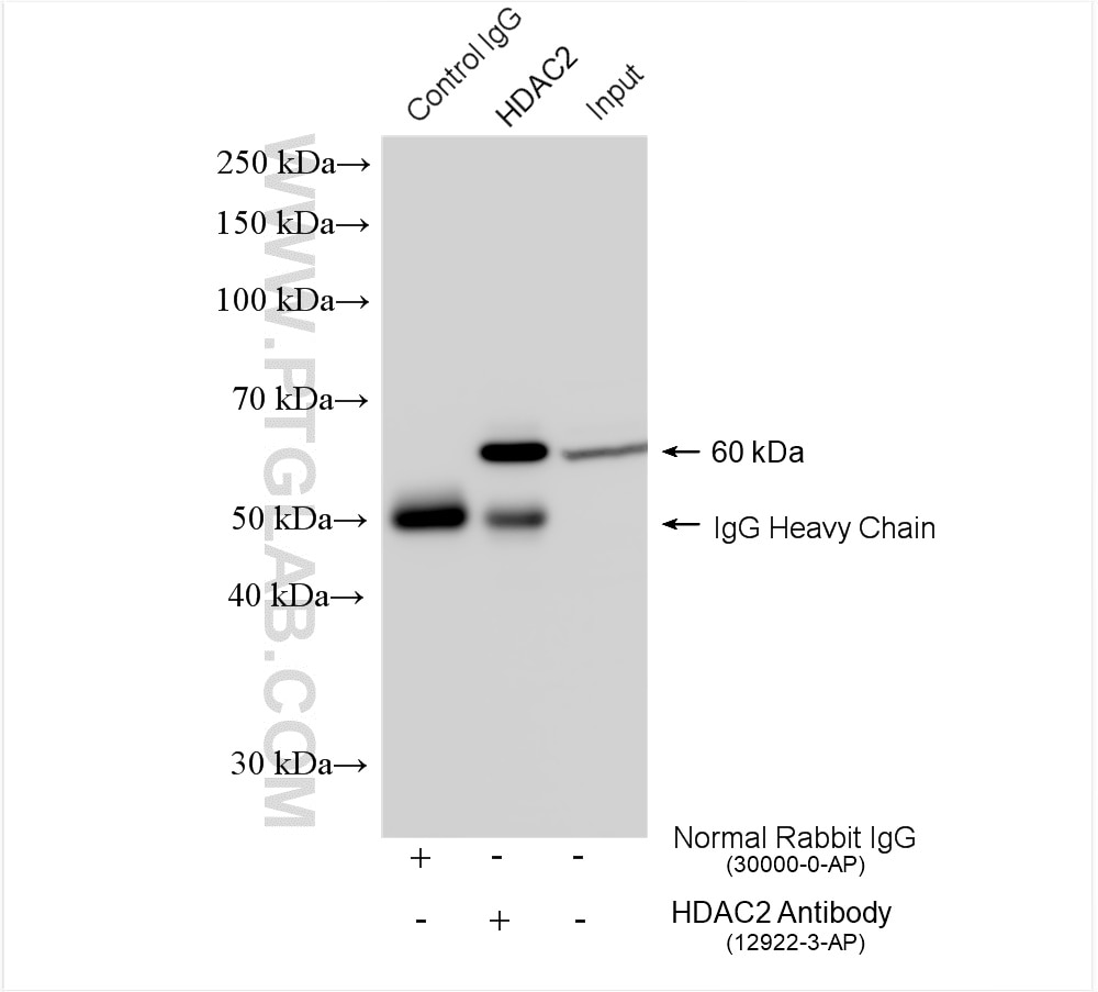 Immunoprecipitation (IP) experiment of HEK-293 cells using HDAC2 Polyclonal antibody (12922-3-AP)