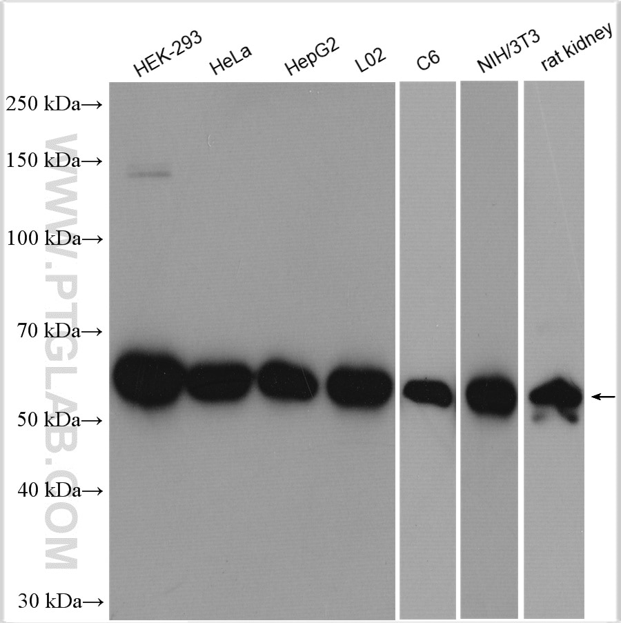 Western Blot (WB) analysis of various lysates using HDAC2 Polyclonal antibody (12922-3-AP)