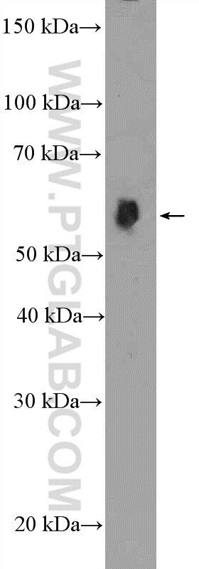 Western Blot (WB) analysis of rat liver tissue using HDAC2 Polyclonal antibody (12922-3-AP)