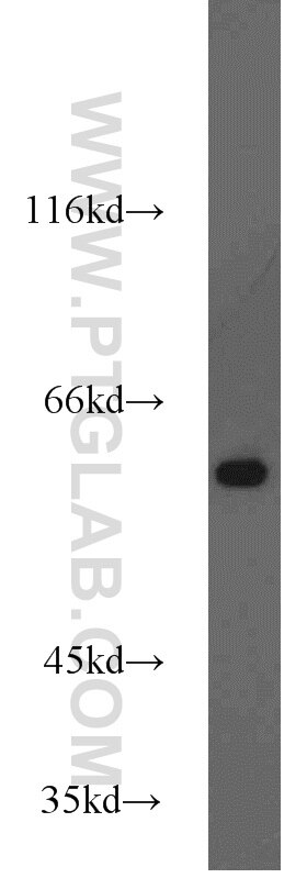 Western Blot (WB) analysis of MCF-7 cells using HDAC2 Polyclonal antibody (12922-3-AP)