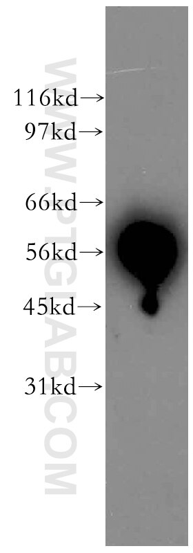 Western Blot (WB) analysis of human kidney tissue using HDAC2 Polyclonal antibody (12922-3-AP)