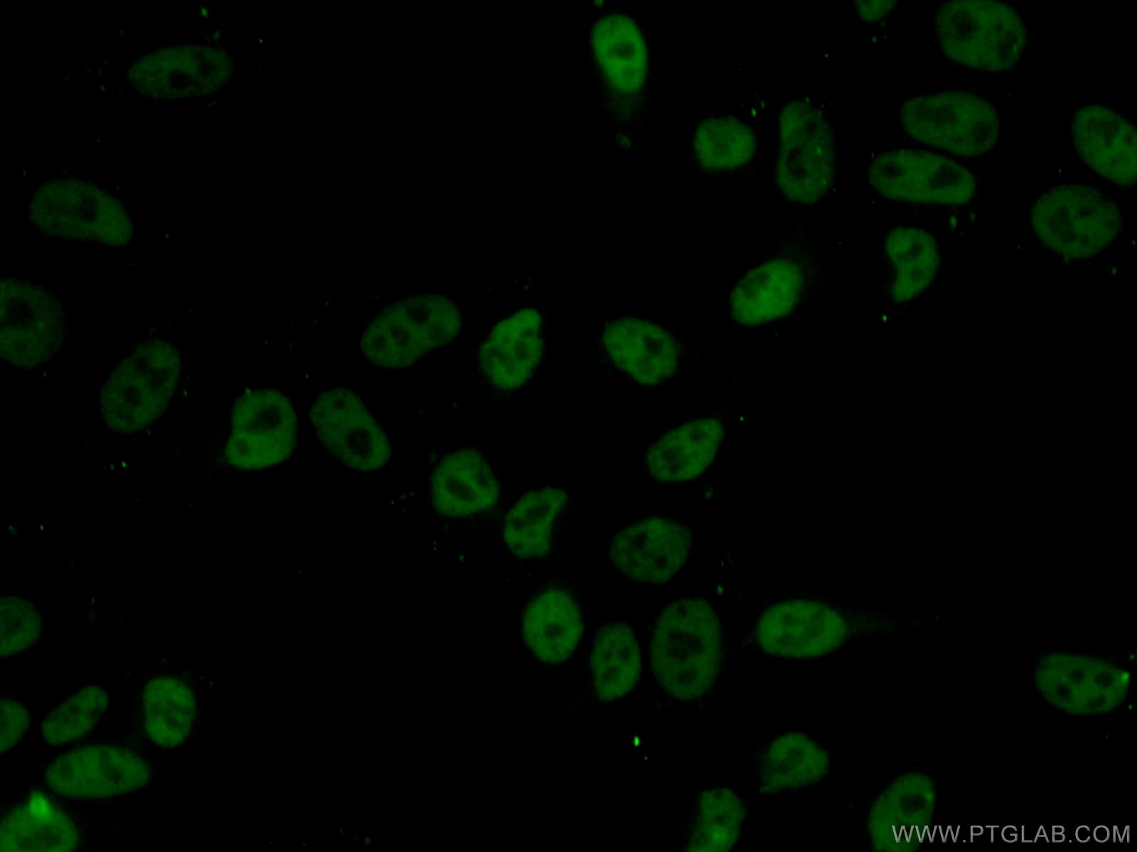 IF Staining of HepG2 using 67165-1-Ig