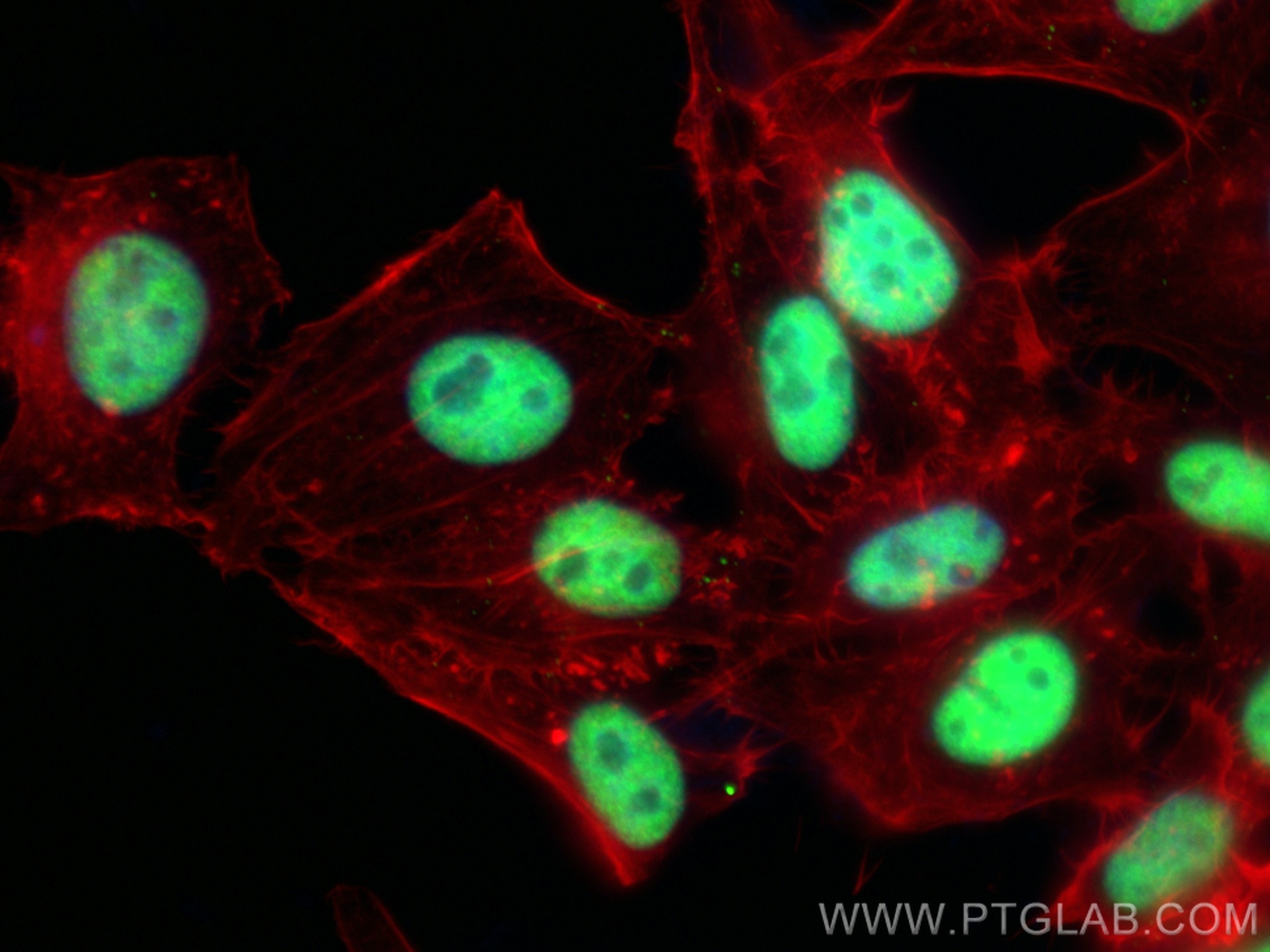 IF Staining of HepG2 using 67165-1-Ig