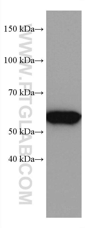 Western Blot (WB) analysis of NCCIT cells using HDAC2 Monoclonal antibody (67165-1-Ig)
