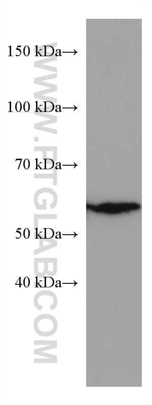 Western Blot (WB) analysis of Jurkat cells using HDAC2 Monoclonal antibody (67165-1-Ig)