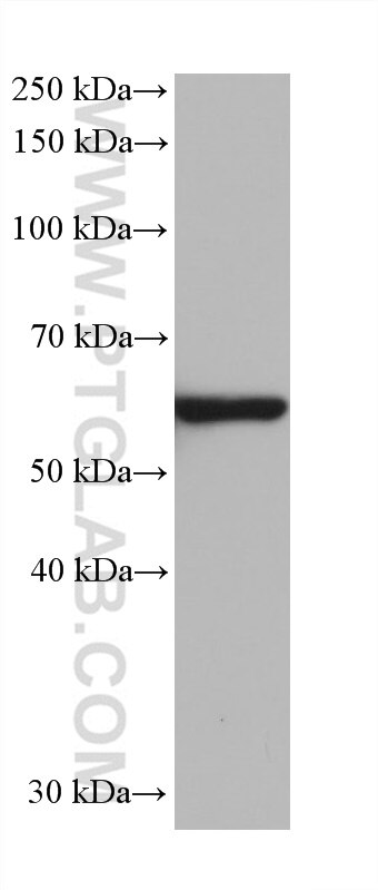 Western Blot (WB) analysis of 4T1 cells using HDAC2 Monoclonal antibody (67165-1-Ig)