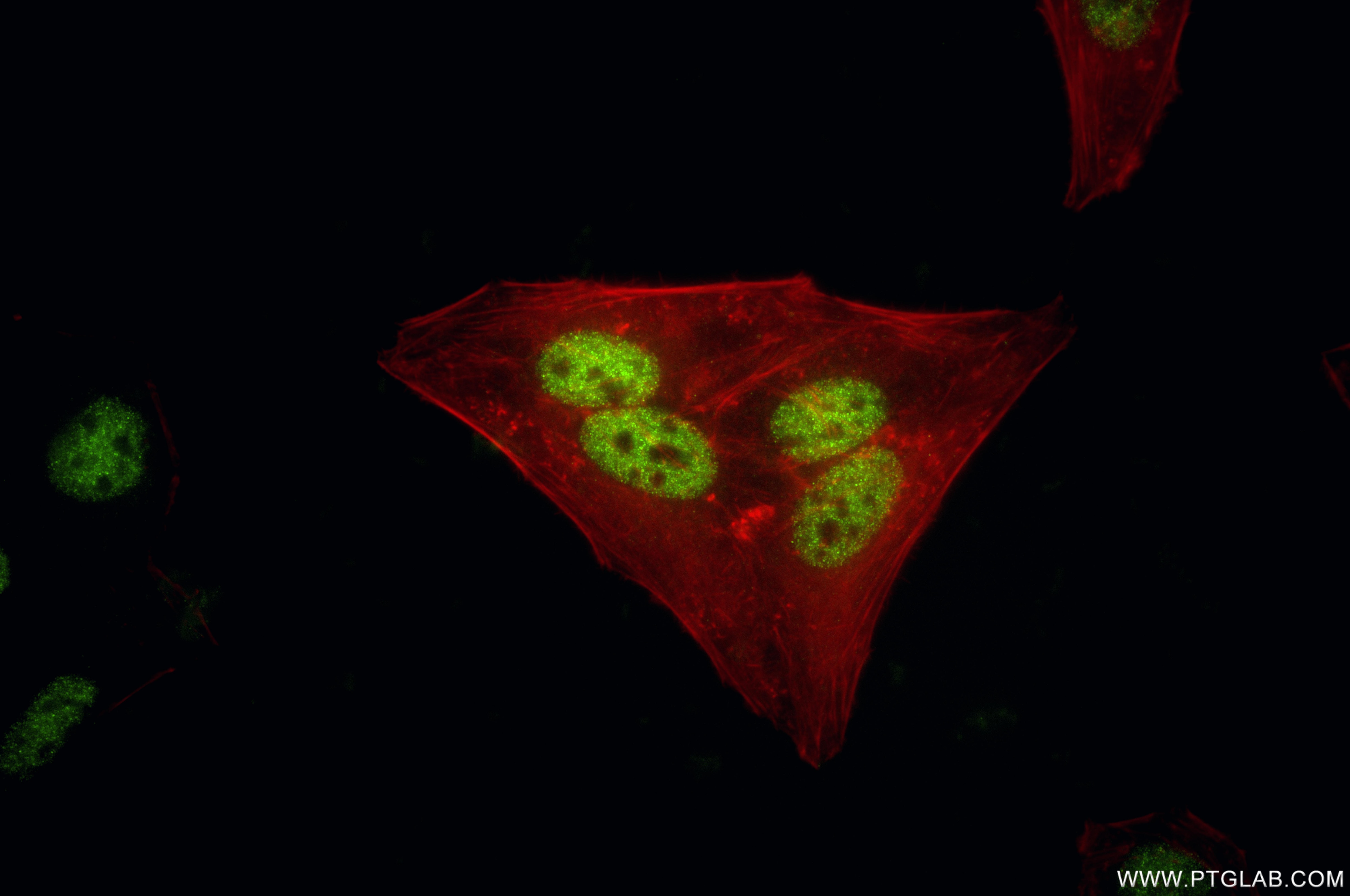 Immunofluorescence (IF) / fluorescent staining of HepG2 cells using HDAC2 Recombinant monoclonal antibody (81497-4-RR)