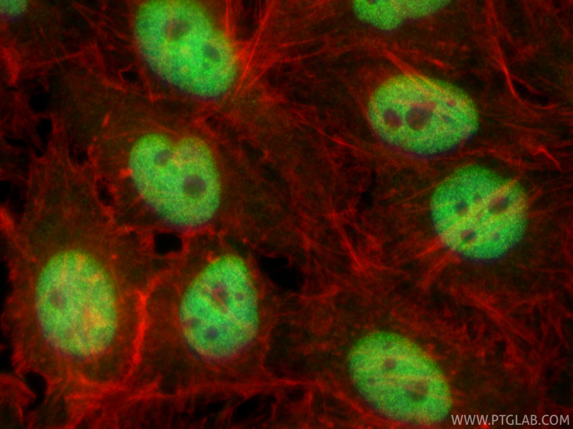 Immunofluorescence (IF) / fluorescent staining of HeLa cells using HDAC2 Recombinant monoclonal antibody (81497-4-RR)