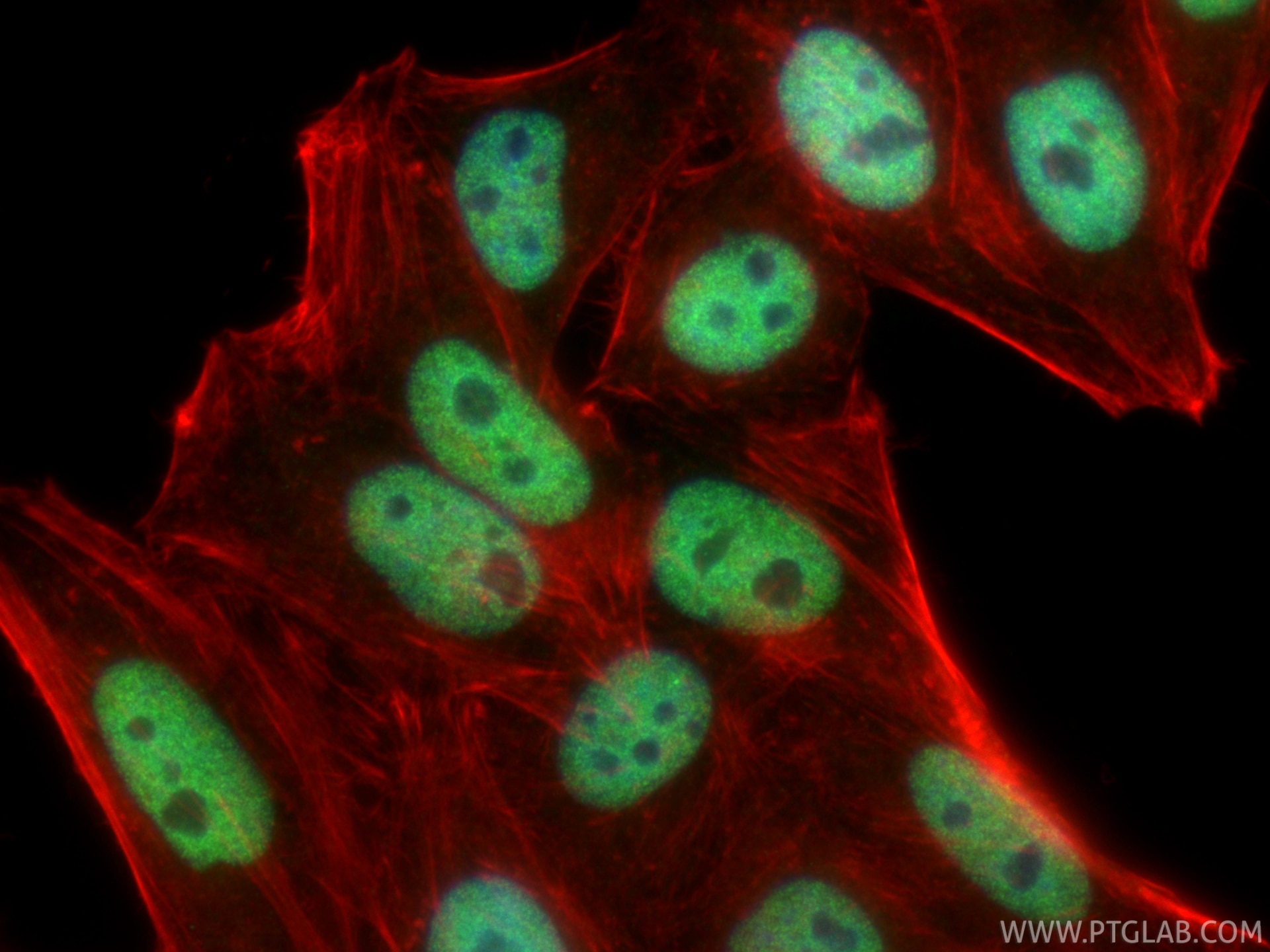 Immunofluorescence (IF) / fluorescent staining of HepG2 cells using HDAC2 Recombinant monoclonal antibody (81497-4-RR)