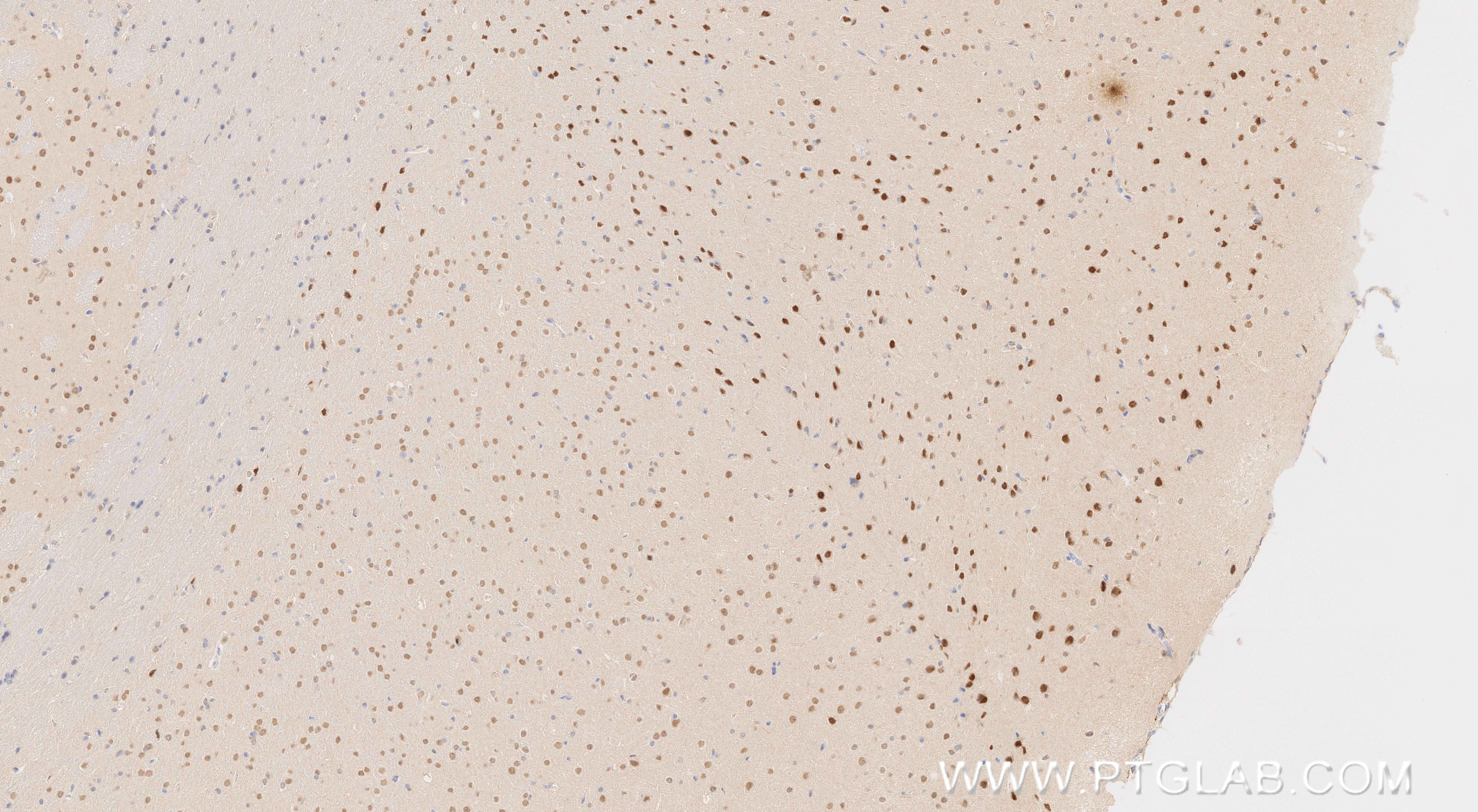 Immunohistochemistry (IHC) staining of mouse brain tissue using HDAC2 Recombinant monoclonal antibody (81497-4-RR)