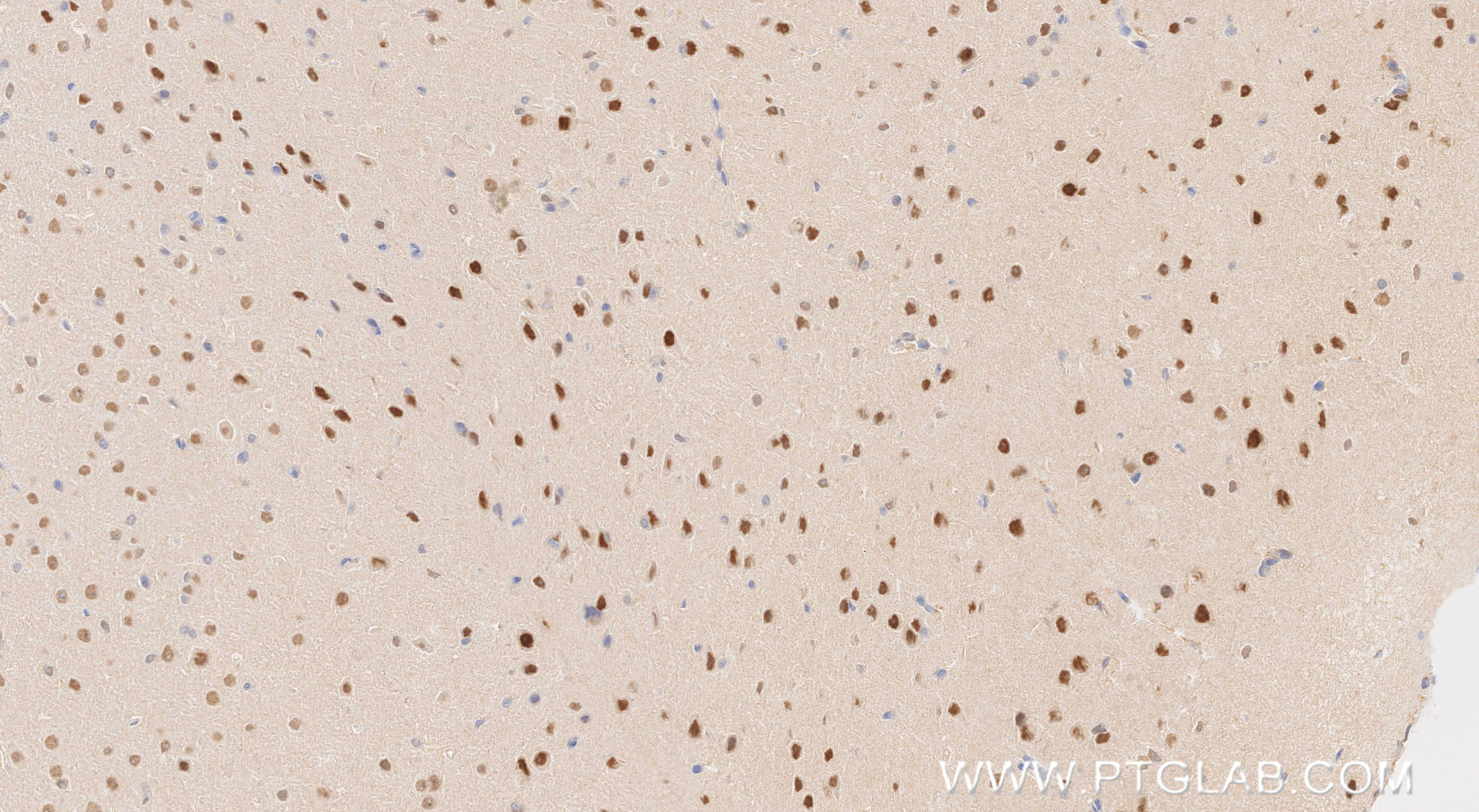 Immunohistochemistry (IHC) staining of mouse brain tissue using HDAC2 Recombinant monoclonal antibody (81497-4-RR)