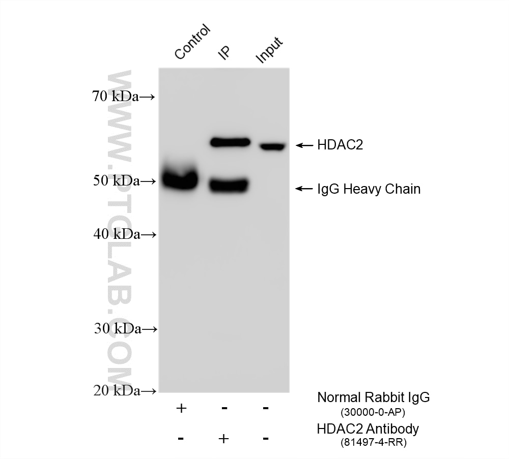 Immunoprecipitation (IP) experiment of HEK-293 cells using HDAC2 Recombinant monoclonal antibody (81497-4-RR)